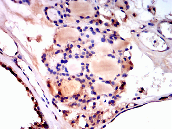 CDK6 Antibody