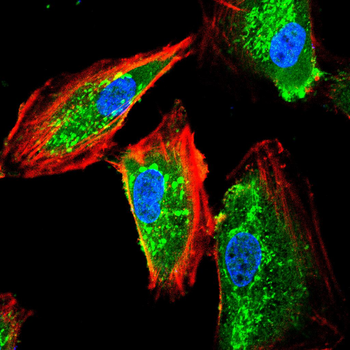 ABCG1 Antibody