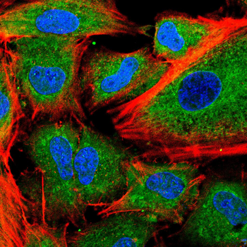 PMP22 Antibody