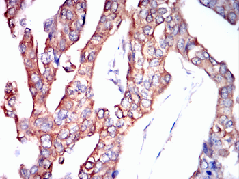 PMP22 Antibody