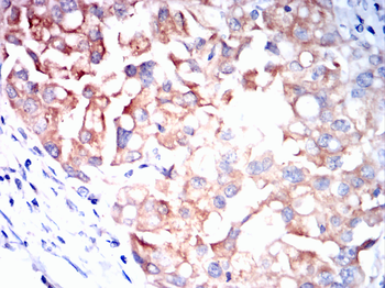 PMP22 Antibody
