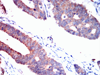 PMP22 Antibody