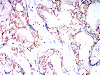 PMP22 Antibody