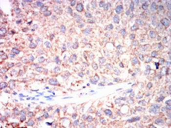PMP22 Antibody