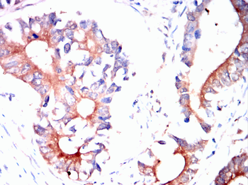 PMP22 Antibody