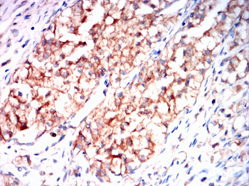 PMP22 Antibody