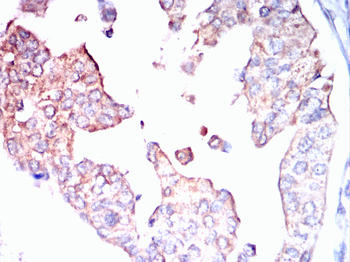 AGER Antibody