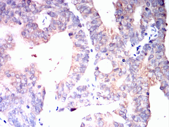 AGER Antibody
