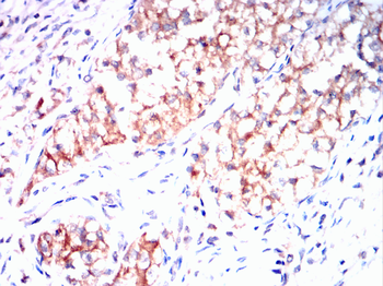 AGER Antibody