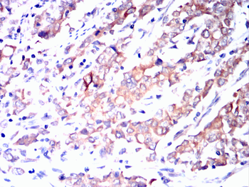 AGER Antibody