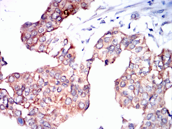 CPT2 Antibody