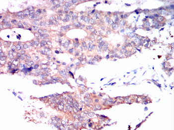 CPT2 Antibody