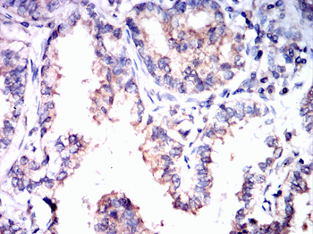 CPT2 Antibody
