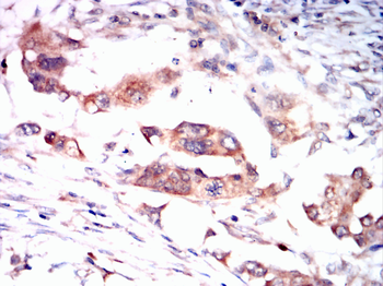 CPT2 Antibody