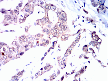 FOXA1 Antibody