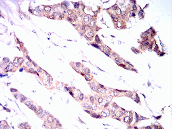 CDK5 Antibody