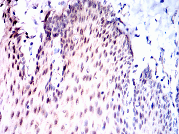 CDK5 Antibody