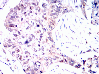 CDK5 Antibody