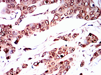 VDR Antibody