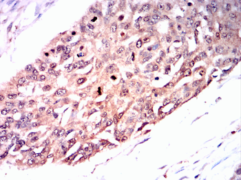 VDR Antibody