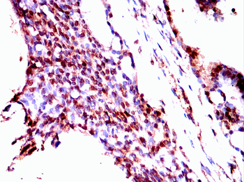 VDR Antibody