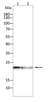 CDKN1B Antibody