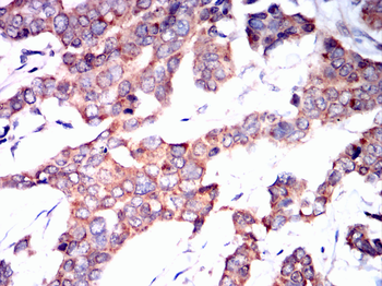 TP53BP1 Antibody
