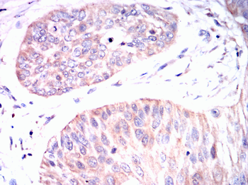 TP53BP1 Antibody
