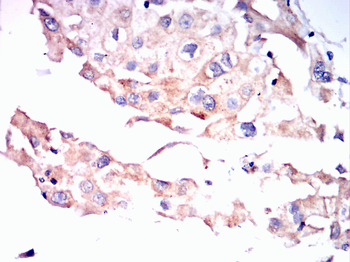 FGF21 Antibody