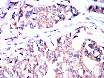 ATG5 Antibody