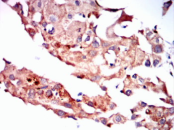 ATG5 Antibody