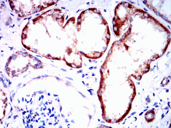TRAF2 Antibody