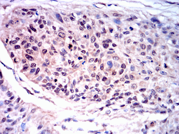 TRAF2 Antibody