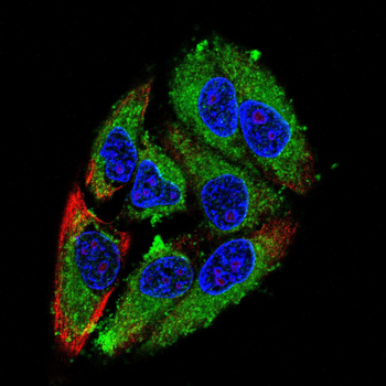 ATM Antibody