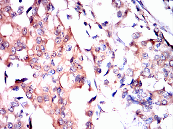 ATM Antibody