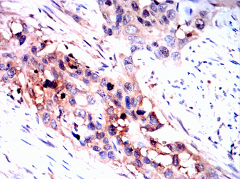 ATM Antibody