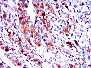ATM Antibody