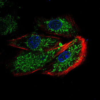 CD40LG Antibody