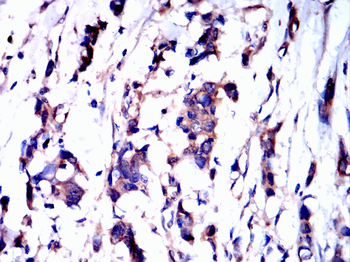 FBXO32 Antibody