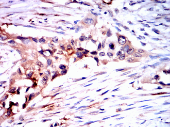 FBXO32 Antibody