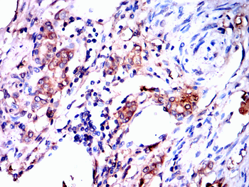 FBXO32 Antibody