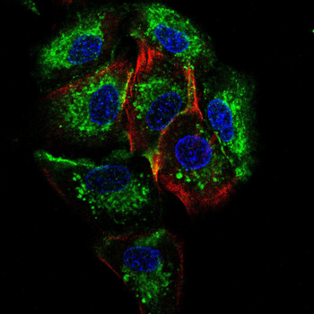 HK1 Antibody