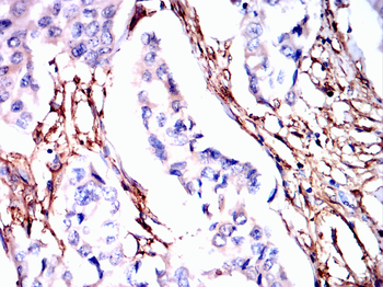 LGALS1 Antibody