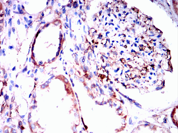 LGALS1 Antibody
