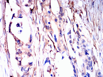 LGALS1 Antibody