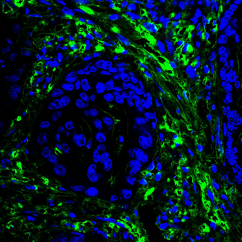 LGALS1 Antibody