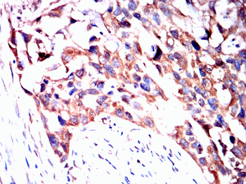 TIA1 Antibody