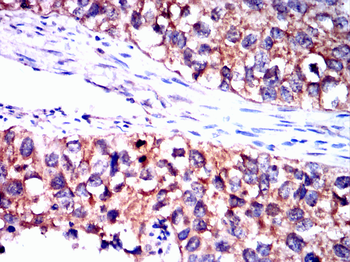 TIA1 Antibody