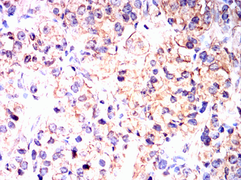 TIA1 Antibody