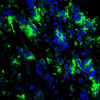 TIA1 Antibody